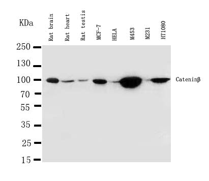 Anti-beta Catenin antibody, PA1212-1, Western blotting
Lane 1: Rat Brain Tissue Lysate
Lane 2: Rat Heart Tissue Lysate
Lane 3: Rat Testis Tissue Lysate
Lane 4: MCF-7 Cell Lysate
Lane 5: HELA Cell Lysate
Lane 6: M453 Cell Lysate
Lane 7: M231 Cell Lysate

Lane 8: HT1080 Cell Lysate