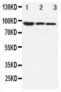 Anti-beta Catenin/CTNNB1 Antibody Picoband®