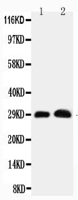 Anti-Aquaporin 5 antibody, PA1230, Western blotting
Working concentration: 0.5μg/ml
Lane 1: Rat Lung Tissue Lysate
Lane 2: Rat Testis Tissue Lysate