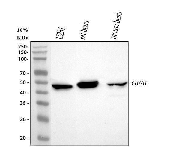 Anti-GFAP Antibody Picoband®