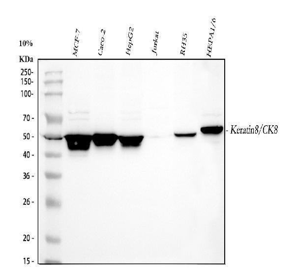 Anti-Cytokeratin 8/KRT8 Antibody Picoband®