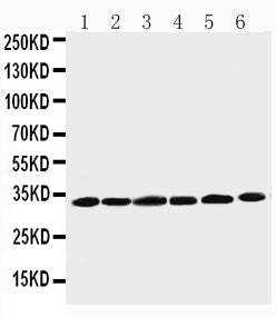 Anti-Cyclin D1 antibody, PA1245-1, Western blotting
Lane 1: Rat Testis Tissue Lysate
Lane 2: Rat Ovary Tissue Lysate
Lane 3: Rat Brain Tissue Lysate
Lane 4: HELA Cell Lysate
Lane 5: MM231 Cell Lysate
Lane 6: SW620 Cell Lysate