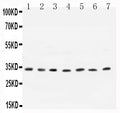 Anti-Cyclin D1/CCND1 Antibody Picoband®