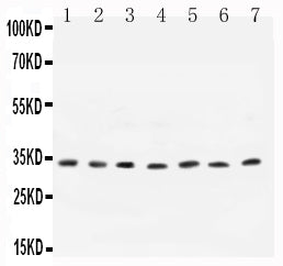 Anti-Cyclin D1/CCND1 Antibody Picoband®