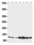 Anti-S100 beta antibody, PA1303, Western blotting
Lane 1: Rat Brain Tissue Lysate
Lane 2: Rat Brain Tissue Lysate
Lane 3: MCF-7 Cell Lysate
Lane 4: HELA Cell Lysate
Lane 5: SMMC Cell Lysate
Lane 6: JURKAT Cell Lysate
Lane 7: COLO320  Cell Lysate