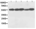 Anti-Caspase-8(P18) antibody, PA1308, Western blotting
All lanes: Anti Caspase-8(P18) (PA1308) at 0.5ug/ml
Lane 1: Rat Thymus Tissue Lysate at 50ug
Lane 2: Rat Liver Tissue Lysate at 50ug
Lane 3: MCF-7 Whole Cell Lysate at 40ug
Lane 4: HELA Whole Cell Lysate at 40ug
Lane 5: SMMC Whole Cell Lysate at 40ug
Predicted bind size: 55KD
Observed bind size: 55KD