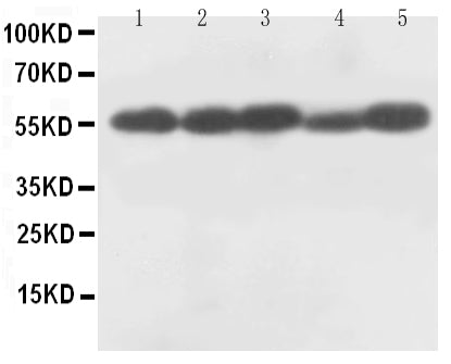 Anti-Caspase-8(P18) antibody, PA1308, Western blotting
All lanes: Anti Caspase-8(P18) (PA1308) at 0.5ug/ml
Lane 1: Rat Thymus Tissue Lysate at 50ug
Lane 2: Rat Liver Tissue Lysate at 50ug
Lane 3: MCF-7 Whole Cell Lysate at 40ug
Lane 4: HELA Whole Cell Lysate at 40ug
Lane 5: SMMC Whole Cell Lysate at 40ug
Predicted bind size: 55KD
Observed bind size: 55KD