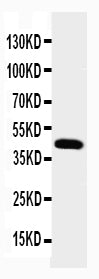 Anti-Podocin NPHS2 Antibody Picoband®