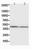 Anti-NPHS2 antibody, PA1322, Western blotting
WB: Rat Kidney Tissue Lysate