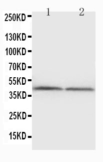 Anti-NPHS2 antibody, PA1322, Western blotting
WB: Rat Kidney Tissue Lysate