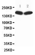 Anti-nNOS(neuronal) antibody, PA1329, Western blotting
All lanes: Anti nNOS(neuronal)(PA1329) at 0.5ug/ml
Lane 1: Rat Brain Tissue Lysate at 50ug
Lane 2: MCF-7 Whole Cell Lysate at 40ug
Predicted bind size: 160KD
Observed bind size: 160KD