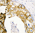 Anti-Cytokeratin 19/KRT19 Antibody Picoband®