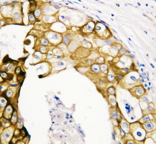 Anti-Cytokeratin 19/KRT19 Antibody Picoband®