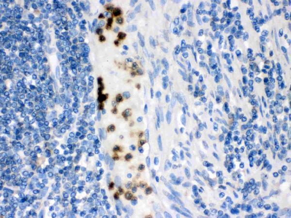 Anti-Cardiac FABP/FABP3 Antibody Picoband®