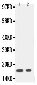 Anti-IL-1 beta antibody, PA1341, Western blotting
Lane 1: Recombinant Human IL-1 beta Protein 20ng
Lane 2: Recombinant Human IL-1 beta Protein 10ng