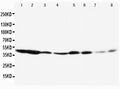 Anti-ERK1/MAPK3 Antibody Picoband®