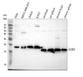 Anti-Superoxide Dismutase 1/SOD1 Antibody Picoband®
