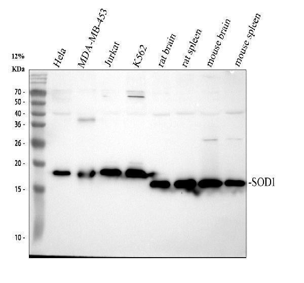 Anti-Superoxide Dismutase 1/SOD1 Antibody Picoband®