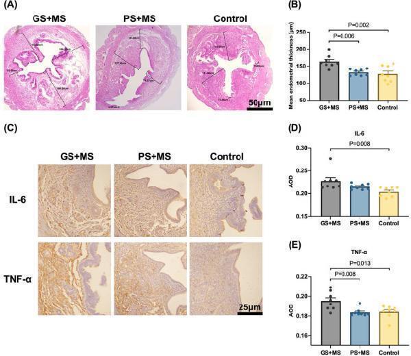 Anti-Interleukin-6 IL6 Antibody Picoband®