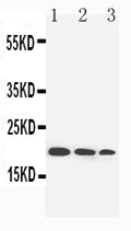 Anti-IL-10 antibody, PA1354, Western blotting
Lane 1: Recombinant Human IL-10 Protein 10ng
Lane 2: Recombinant Human IL-10 Protein 5ng 
Lane 3: Recombinant Human IL-10 Protein 2.5ng