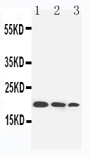 Anti-IL-10 antibody, PA1354, Western blotting
Lane 1: Recombinant Human IL-10 Protein 10ng
Lane 2: Recombinant Human IL-10 Protein 5ng 
Lane 3: Recombinant Human IL-10 Protein 2.5ng