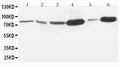 Anti-MMP-9 antibody, PA1357, Western blotting
Lane 1: Rat Embryo Tissue Lysate
Lane 2: MM453 Cell Lysate
Lane 3: HELA Cell Lysate
Lane 4: SMMC Cell Lysate
Lane 5: JURKAT Cell Lysate
Lane 6: HT1080 Cell Lysate