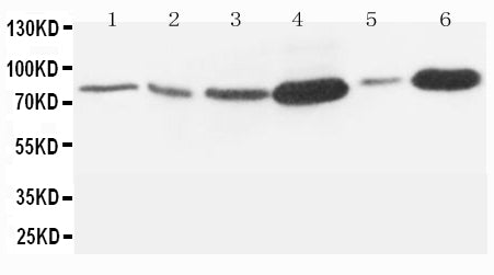 Anti-MMP-9 antibody, PA1357, Western blotting
Lane 1: Rat Embryo Tissue Lysate
Lane 2: MM453 Cell Lysate
Lane 3: HELA Cell Lysate
Lane 4: SMMC Cell Lysate
Lane 5: JURKAT Cell Lysate
Lane 6: HT1080 Cell Lysate