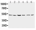 Anti-Presenilin 2 antibody, PA1358, Western blotting
Lane 1: Rat Brain Tissue Lysate 
Lane 2: Rat Brain Tissue Lysate 
Lane 3: MCF-7 Cell Lysate 
Lane 4: HELA Cell Lysate 
Lane 5: SMMC Cell Lysate 
Lane 6: CEM Cell Lysate