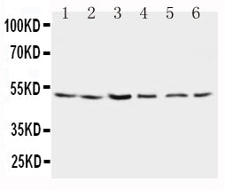 Anti-Presenilin 2 antibody, PA1358, Western blotting
Lane 1: Rat Brain Tissue Lysate 
Lane 2: Rat Brain Tissue Lysate 
Lane 3: MCF-7 Cell Lysate 
Lane 4: HELA Cell Lysate 
Lane 5: SMMC Cell Lysate 
Lane 6: CEM Cell Lysate
