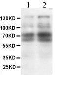 Anti-L-selectin antibody, PA1359, Western blotting
All lanes: Anti L-selectin (PA1359) at 0.5ug/ml

Lane 1: Rat Spleen Tissue Lysate at 50ug

Lane 2: Mouse Spleen Tissue Lysate at 50ug

Predicted bind size: 42KD

Observed bind size: 70KD