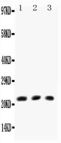 Anti-TNF beta antibody, PA1361-1, All Western blotting
All lanes: Anti-TNF beta(PA1361-1) at 0.5ug/ml

Lane 1: HELA Whole Cell Lysate at 40ug

Lane 2: MCF-7 Whole Cell Lysate at 40ug

Lane 3: COLO320 Whole Cell Lysate at 40ug

Predicted bind size: 22KD

Observed bind size: 22KD