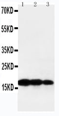 Anti-TNF beta antibody, PA1361, Western blotting
Lane 1: Recombinant Human TNF beta Protein 10ng
Lane 2: Recombinant Human TNF beta Protein 5ng
Lane 3: Recombinant Human TNF beta Protein 2.5ng