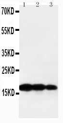 Anti-TNF beta antibody, PA1361, Western blotting
Lane 1: Recombinant Human TNF beta Protein 10ng
Lane 2: Recombinant Human TNF beta Protein 5ng
Lane 3: Recombinant Human TNF beta Protein 2.5ng