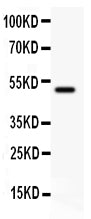 Anti-CD80 antibody, PA1365-1, Western blotting
All lanes: Anti CD80 (PA1365-1) at 0.5ug/ml
WB: Rat Thymus Tissue Lysate at 50ug
Predicted bind size: 34KD
Observed bind size: 50KD