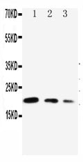 Anti-CDC42 antibody, PA1366, Western blotting
Lane 1: Recombinant Human CDC42 Protein 10ng
Lane 2: Recombinant Human CDC42 Protein 5ng
Lane 3: Recombinant Human CDC42 Protein 2.5ng