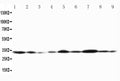 Anti-Connexin 32/GJB1 Antibody Picoband®