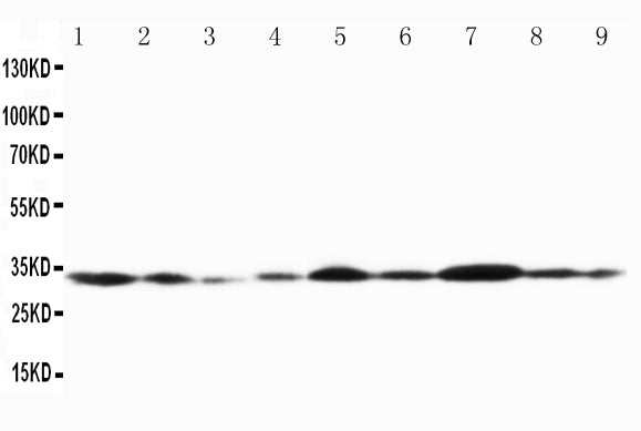 Anti-Connexin 32/GJB1 Antibody Picoband®