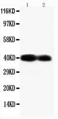 Anti-Connexin 40/GJA5 antibody, PA1368, Western blotting
Lane 1: Mouse Heart Tissue Lysate
Lane 2:  Mouse Heart Tissue Lysate