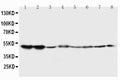 Anti-5HT2A Receptor antibody, PA1373, Western blotting
Lane 1: Rat Brain Tissue Lysate
Lane 2: Rat Brain Tissue Lysate
Lane 3: Mouse Brain Tissue Lysate
Lane 4: Mouse Brain Tissue Lysate
Lane 5: U87 Cell Lysate
Lane 6: SMMC Cell Lysate
Lane 7: HT1080 Cell Lysate

Lane 8: COLO320 Cell Lysate