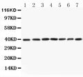 Anti-MEK3 antibody, PA1377-1, All Western blotting
All lanes: Anti-MAP2K3(PA1377-1) at 0.5ug/ml

Lane 1: Rat Skeletal Muscle Tissue Lysate at 40ug

Lane 2: Rat Kidney Tissue Lysate at 40ug

Lane 3: Rat Spleen Tissue Lysate at 40ug

Lane 4: HELA Whole Cell Lysate at 40ug

Lane 5: A549 Whole Cell Lysate at 40ug

Lane 6: JURKAT Whole Cell Lysate at 40ug

Lane 7: CEM Whole Cell Lysate at 40ug

Predicted bind size: 39KD

Observed bind size: 39KD