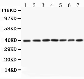 Anti-MEK3 antibody, PA1377-1, All Western blotting
All lanes: Anti-MAP2K3(PA1377-1) at 0.5ug/ml

Lane 1: Rat Skeletal Muscle Tissue Lysate at 40ug

Lane 2: Rat Kidney Tissue Lysate at 40ug

Lane 3: Rat Spleen Tissue Lysate at 40ug

Lane 4: HELA Whole Cell Lysate at 40ug

Lane 5: A549 Whole Cell Lysate at 40ug

Lane 6: JURKAT Whole Cell Lysate at 40ug

Lane 7: CEM Whole Cell Lysate at 40ug

Predicted bind size: 39KD

Observed bind size: 39KD