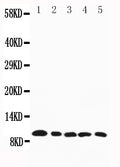 All lanes: Anti-CCL4, PA1379
Lane 1: Mouse Spleen Tissue Lysate

Lane 2: Mouse Cardiac Muscle Tissue Lysate

Lane 3: Mouse Lung Tissue Lysate

Lane 4: Mouse Kidney Tissue Lysate

Lane 5: Mouse Skeletal Muscle Tissue Lysate
