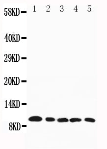 All lanes: Anti-CCL4, PA1379
Lane 1: Mouse Spleen Tissue Lysate

Lane 2: Mouse Cardiac Muscle Tissue Lysate

Lane 3: Mouse Lung Tissue Lysate

Lane 4: Mouse Kidney Tissue Lysate

Lane 5: Mouse Skeletal Muscle Tissue Lysate