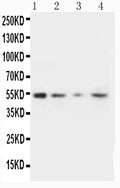 Anti-MMP10 antibody, PA1380, Western blotting
Lane 1: Recombinant Human MMP-10 Protein 10ng
Lane 2: Recombinant Human MMP-10 Protein 5ng
Lane 3: Recombinant Human MMP-10 Protein 2.5ng

Lane 4: HELA Cell Lysate