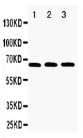 Anti-RANK antibody, PA1382, Western blotting
Lane 1: Recombinant Human RANK Protein 10ng
Lane 2: Recombinant Human RANK Protein 5ng
Lane 3: Recombinant Human RANK Protein 2.5ng