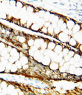 Anti-Metalloproteinase inhibitor 1 TIMP1 Antibody Picoband®