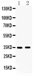 Anti-HSD17B6 Antibody Picoband®