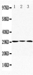 Anti-Apolipoprotein D antibody, PA1388, Western blotting
Lane 1: MCF-7 Cell Lysate
Lane 2: HELA Cell Lysate
Lane 3: SMMC Cell Lysate
