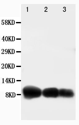 Anti-IP10 antibody, PA1396, Western blotting
Lane 1: Recombinant Human CXCL10 Protein 10ng
Lane 2: Recombinant Human CXCL10 Protein 5ng
Lane 3: Recombinant Human CXCL10 Protein 2.5ng