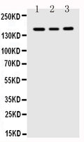 Anti-FLT1 antibody, PA1399, Western blotting
Lane 1: MCF-7 Cell Lysate
Lane 2: SGC Cell Lysate
Lane 3: MM231 Cell Lysate